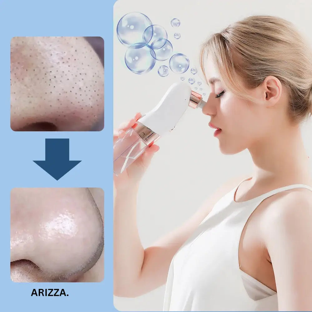 Bubble Facial Blackhead Removal Vacuum White