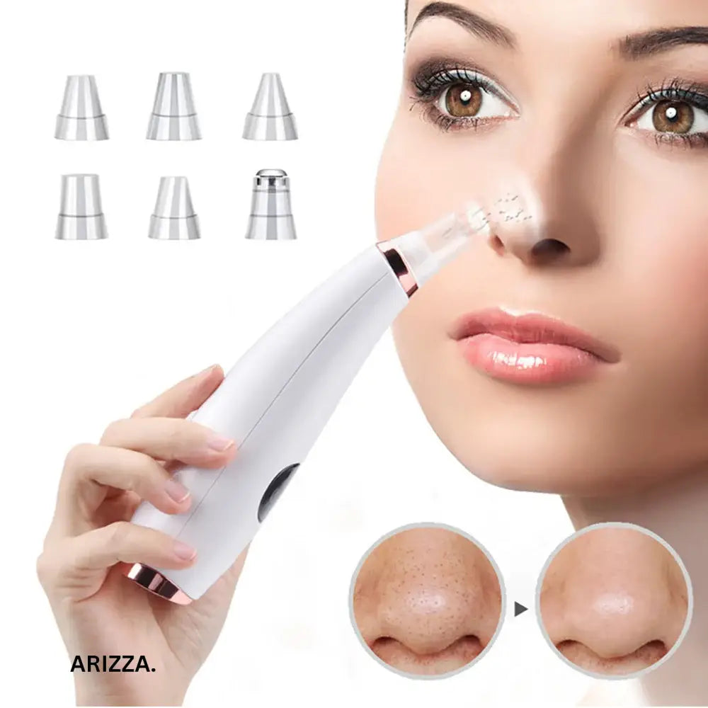 Deep Cleansing Electric Blackhead Remover Vacuum blackhead 02