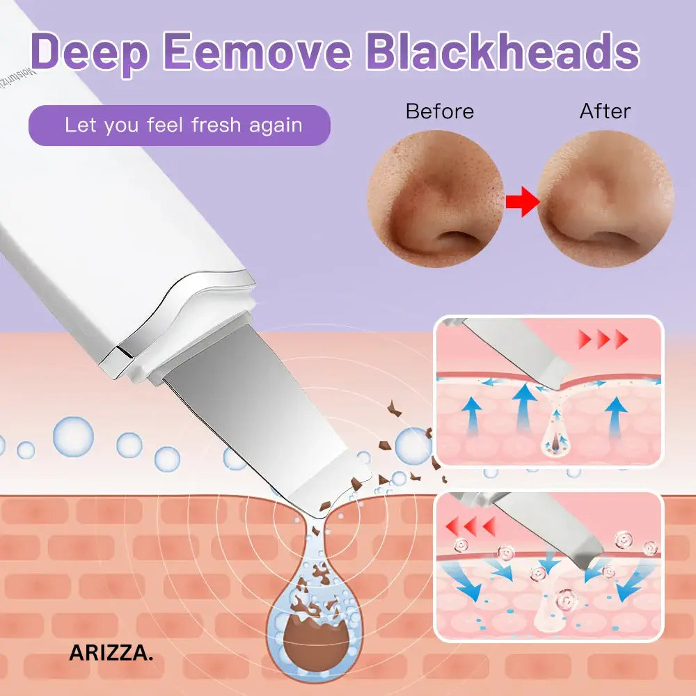 Electric Vibration Ultrasonic Skin Scrubber